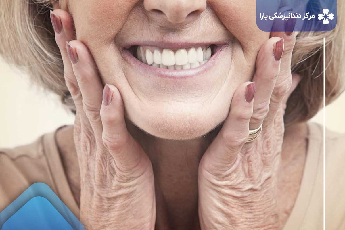 عکس دندان مصنوعی در تهران پارس