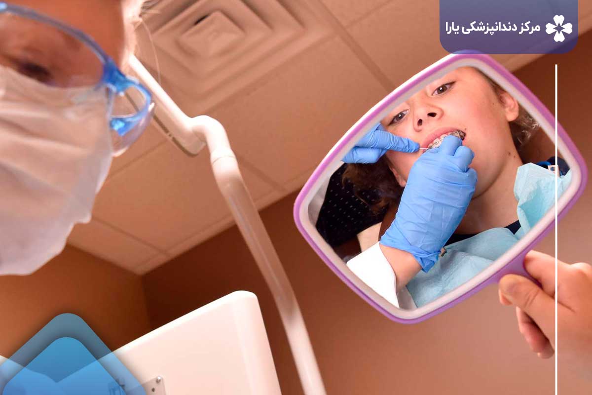دندانپزشکی اطفال در تهرانپارس چه می‌کند؟