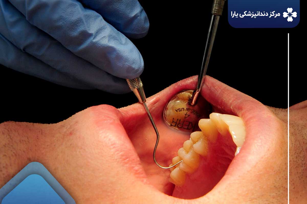 چرا معاینه روتین دندانپزشکی مهم است؟