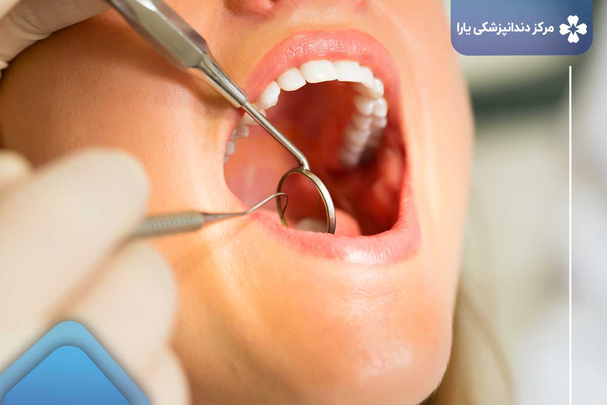 هزینه درمان مناسب با هر بودجه در دندانپزشکی در تهرانپارس: