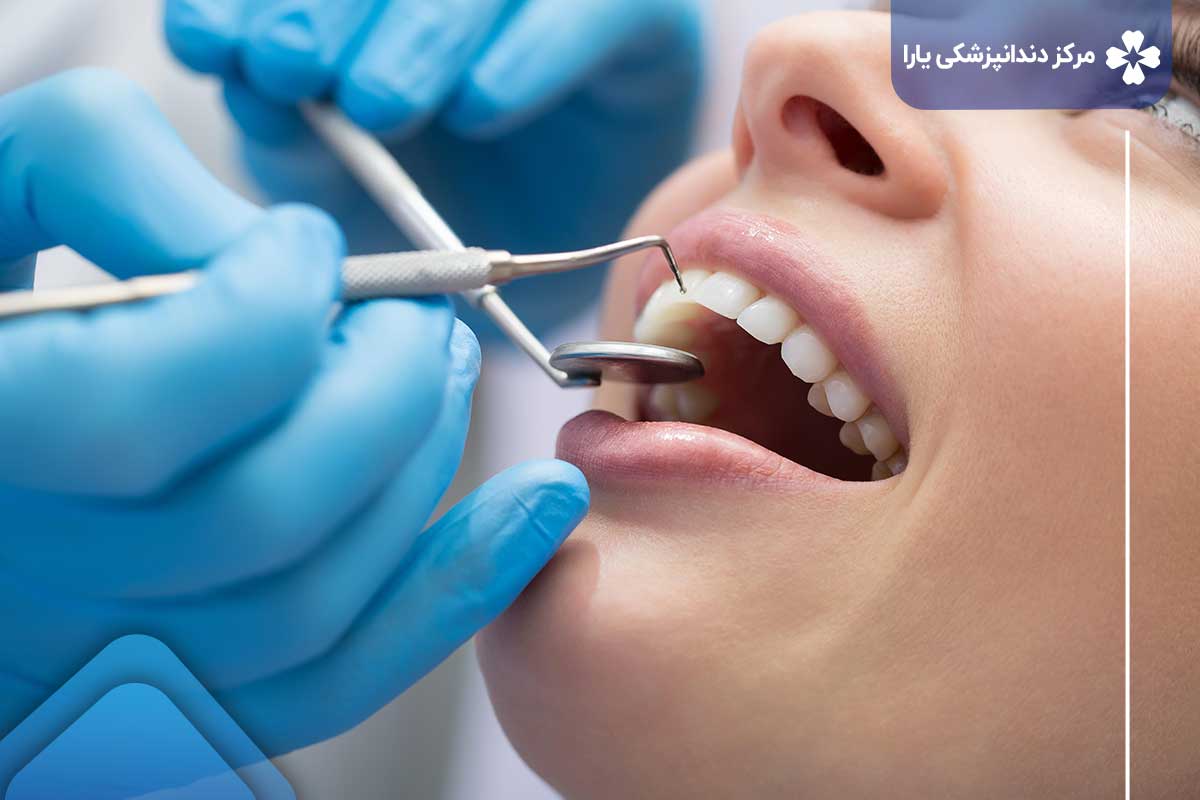 هزینه خدمات دندانپزشکی در تهرانپارس