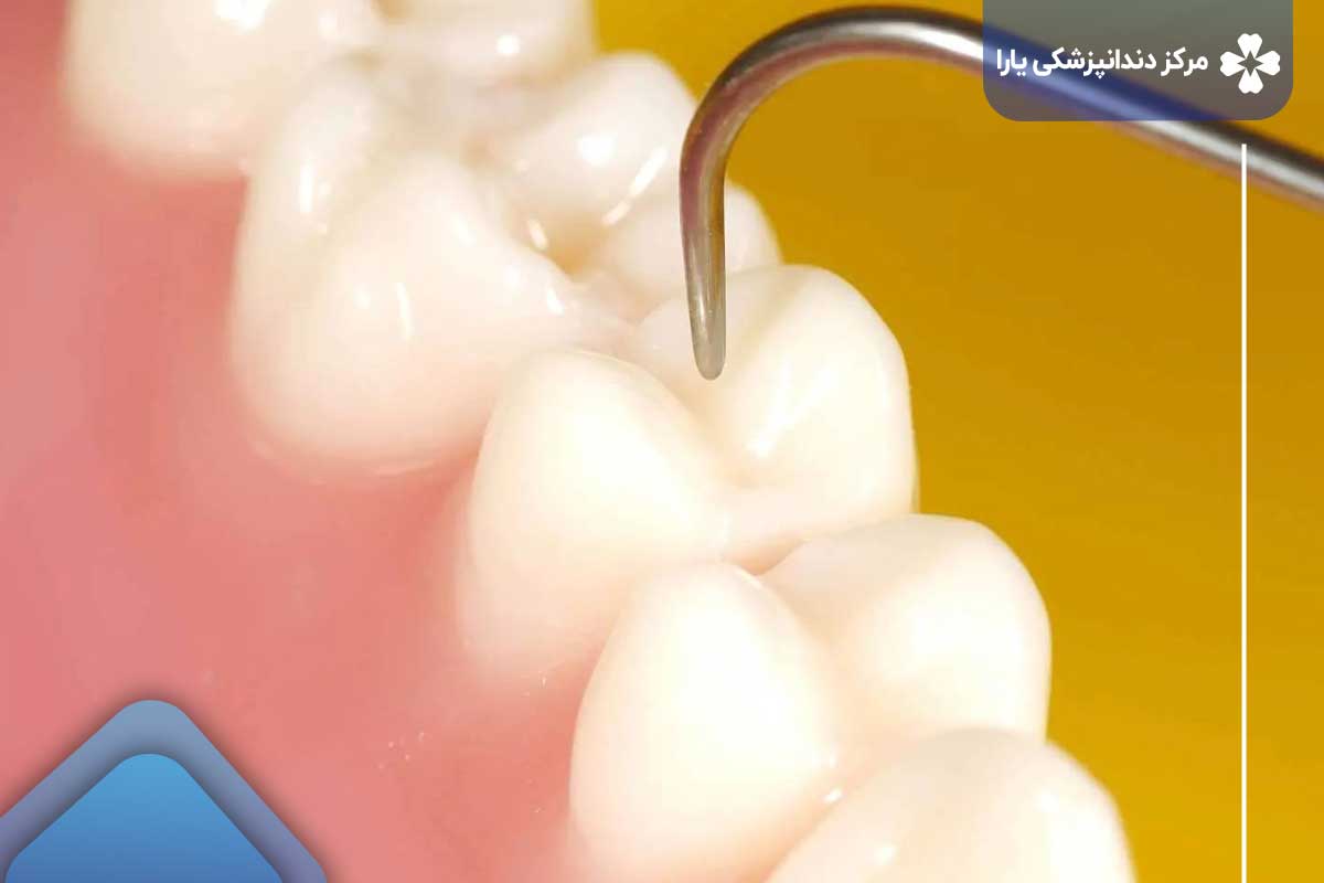 دلایل  نیاز به مراجعه به اورژانس دندانپزشکی تهرانپارس چیست؟