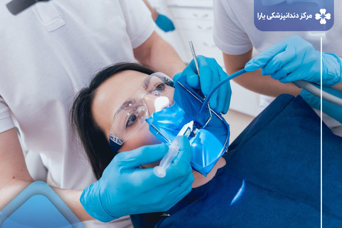 هزینه عصب کشی دندان در تهرانپارس: عوامل موثر بر هزینه عصب کشی دندان