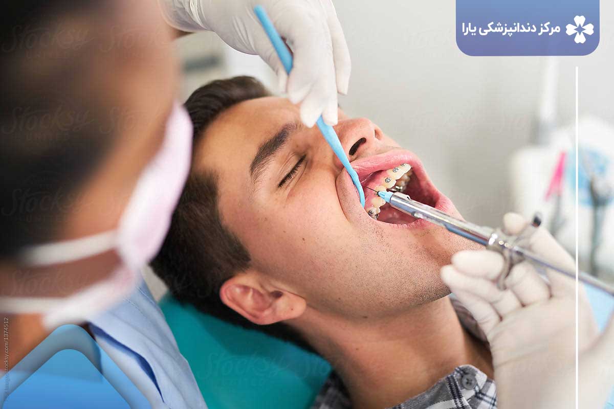تکنیک‌های مورد استفاده در دندانپزشکی با بیهوشی (دندانپزشکی بدون درد)