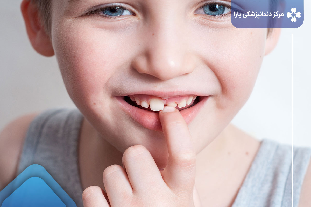 آیا کودکان می‌توانند بدون بی حسی تحت عصب کشی دندان قرار گیرند؟