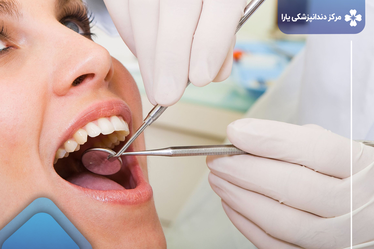 هزینه ویزیت و معاینه دندانپزشکی در سال ۱۴۰۲ چقدر است؟