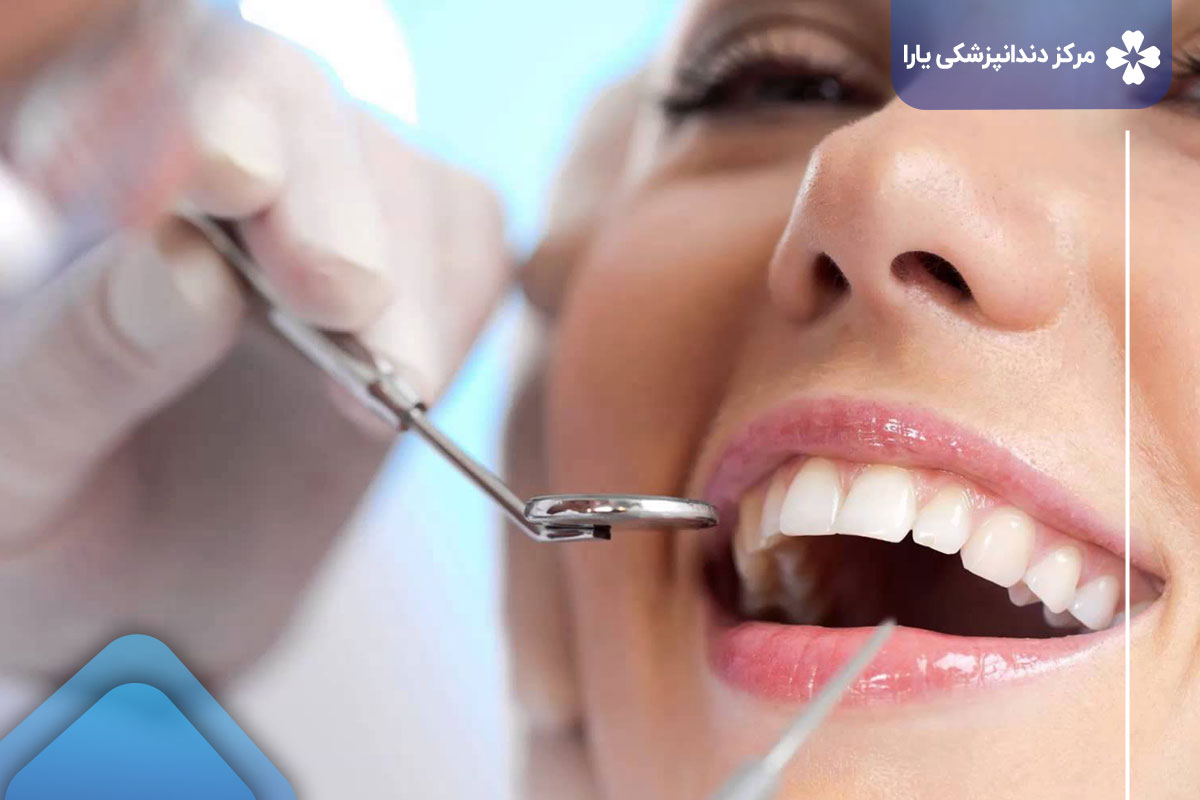 دندانپزشک خوب برای لمینت دندان در تهرانپارس