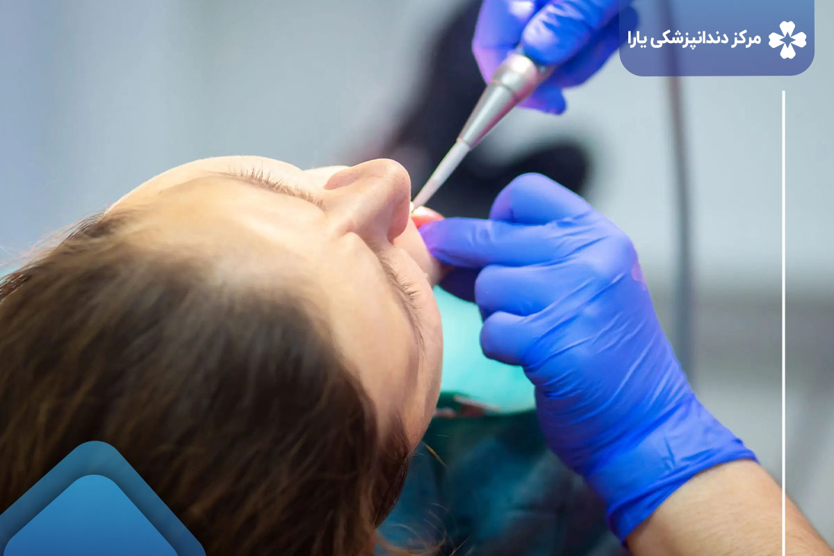جراحی دندان در تهرانپارس
