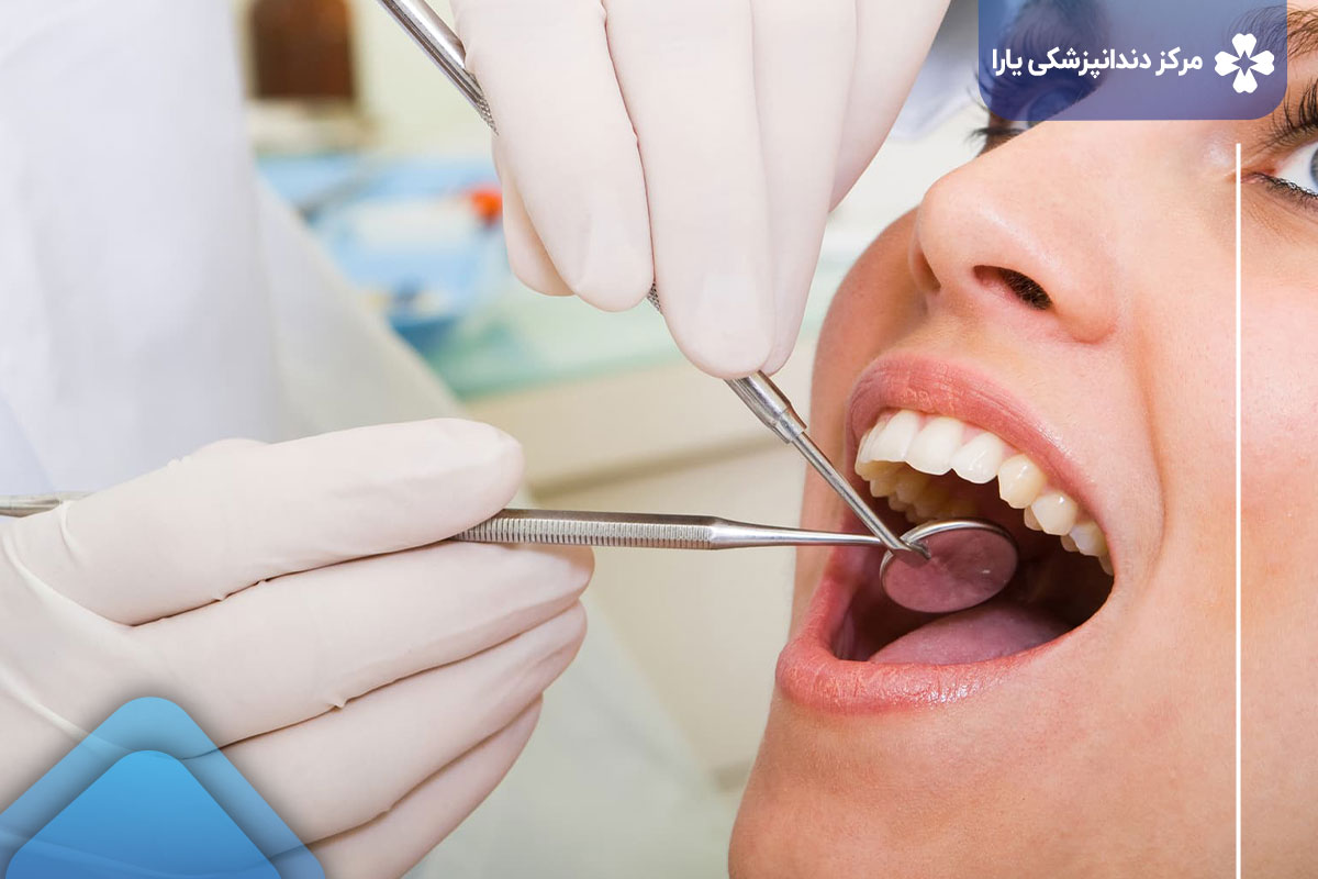 بازسازی دندان پوسیده