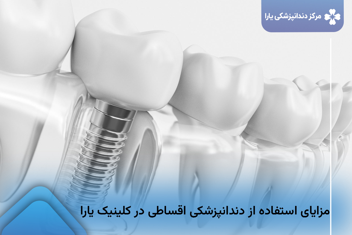 مزایای استفاده از دندانپزشکی اقساطی 