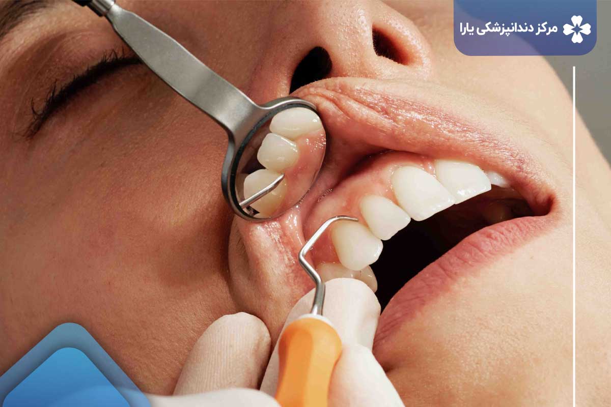 خدمات دندانپزشکی ارزان در شرق تهران