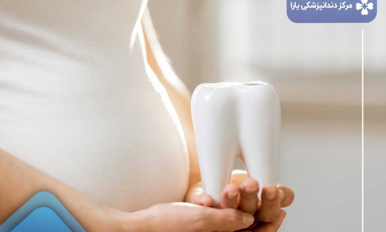 لمینت دندان در دوران بارداری