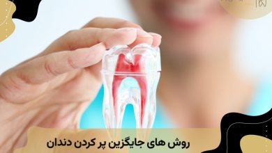 روش های جایگزین پرکردن دندان