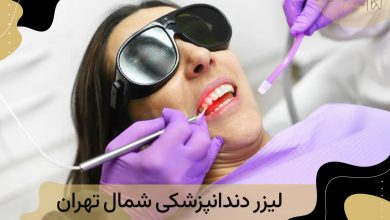 لیزر دندانپزشکی شمال تهران