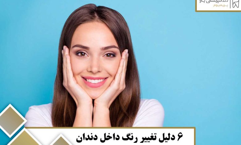 6 دلیل تغییر رنگ داخل دندان