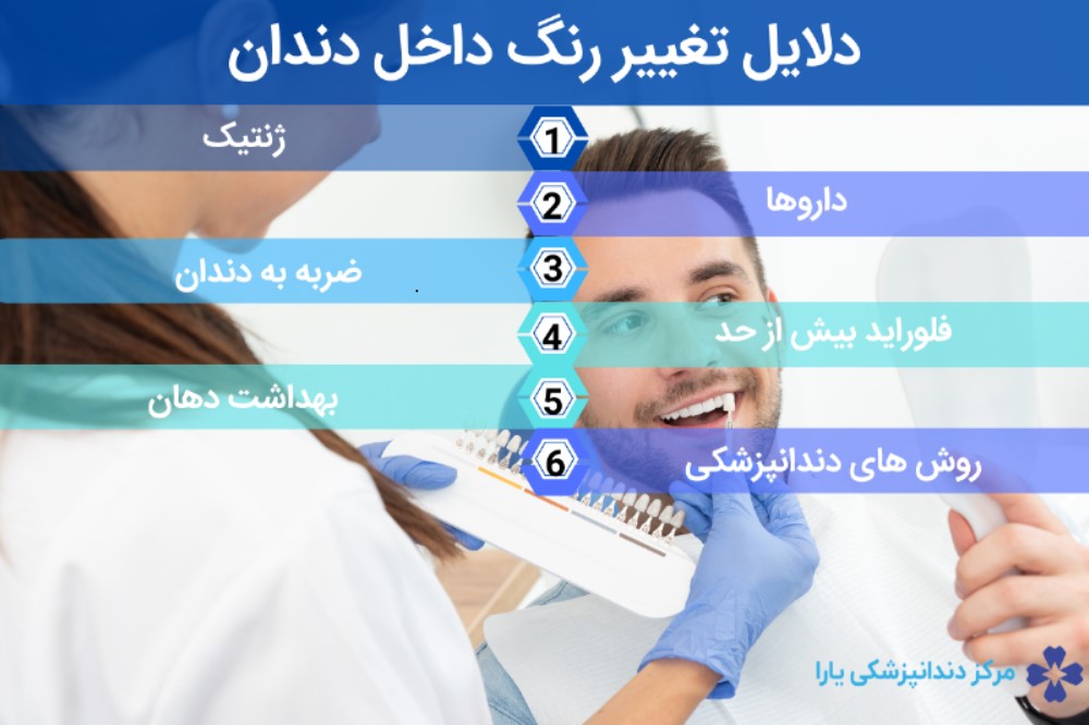 دلایل تغییر رنگ دندان