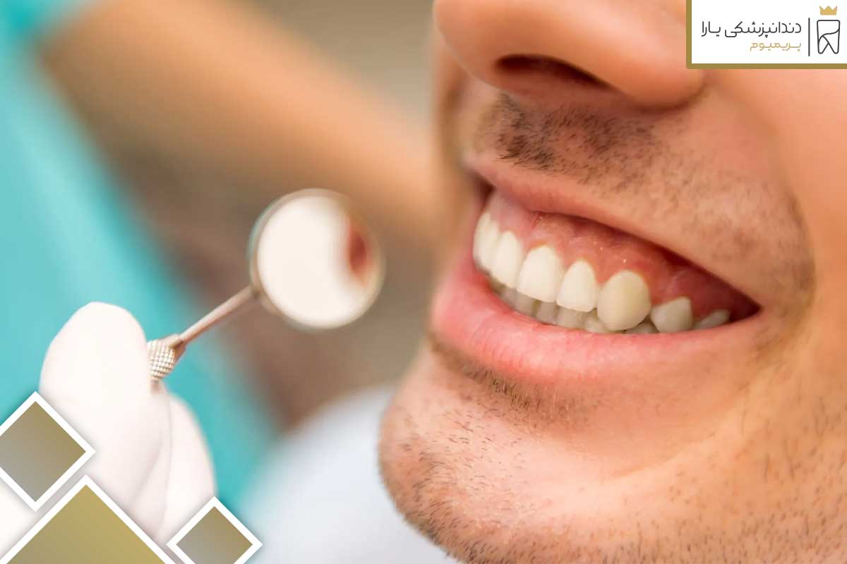 Frequently asked questions about the price of dental services in Angel