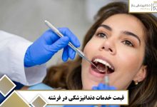 قیمت خدمات دندانپزشکی در فرشته