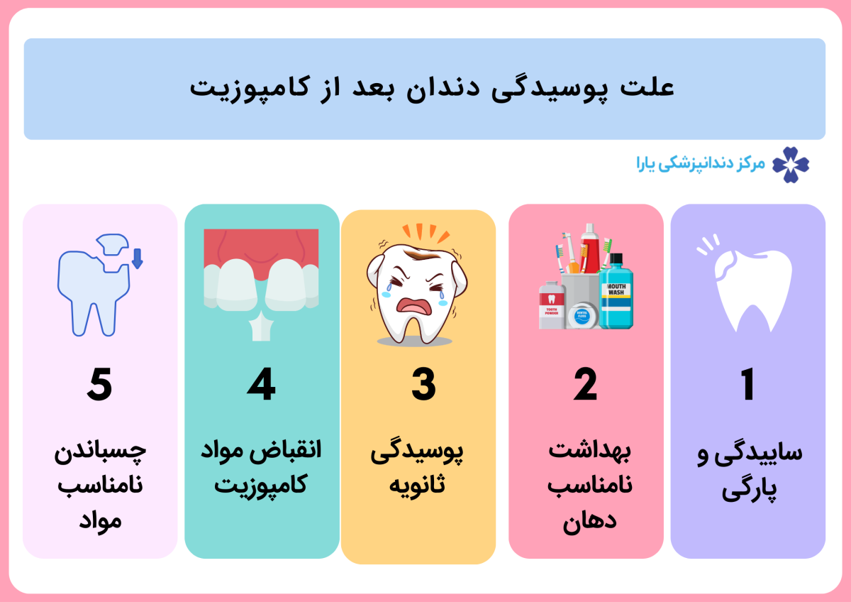 علت پوسیدگی دندان بعد از کامپوزیت 