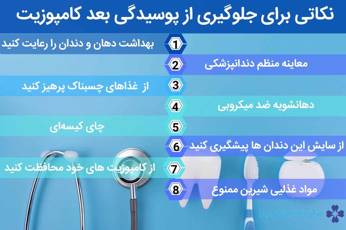 نکاتی برای جلوگیری از پوسیدگی بعد کامپوزیت 