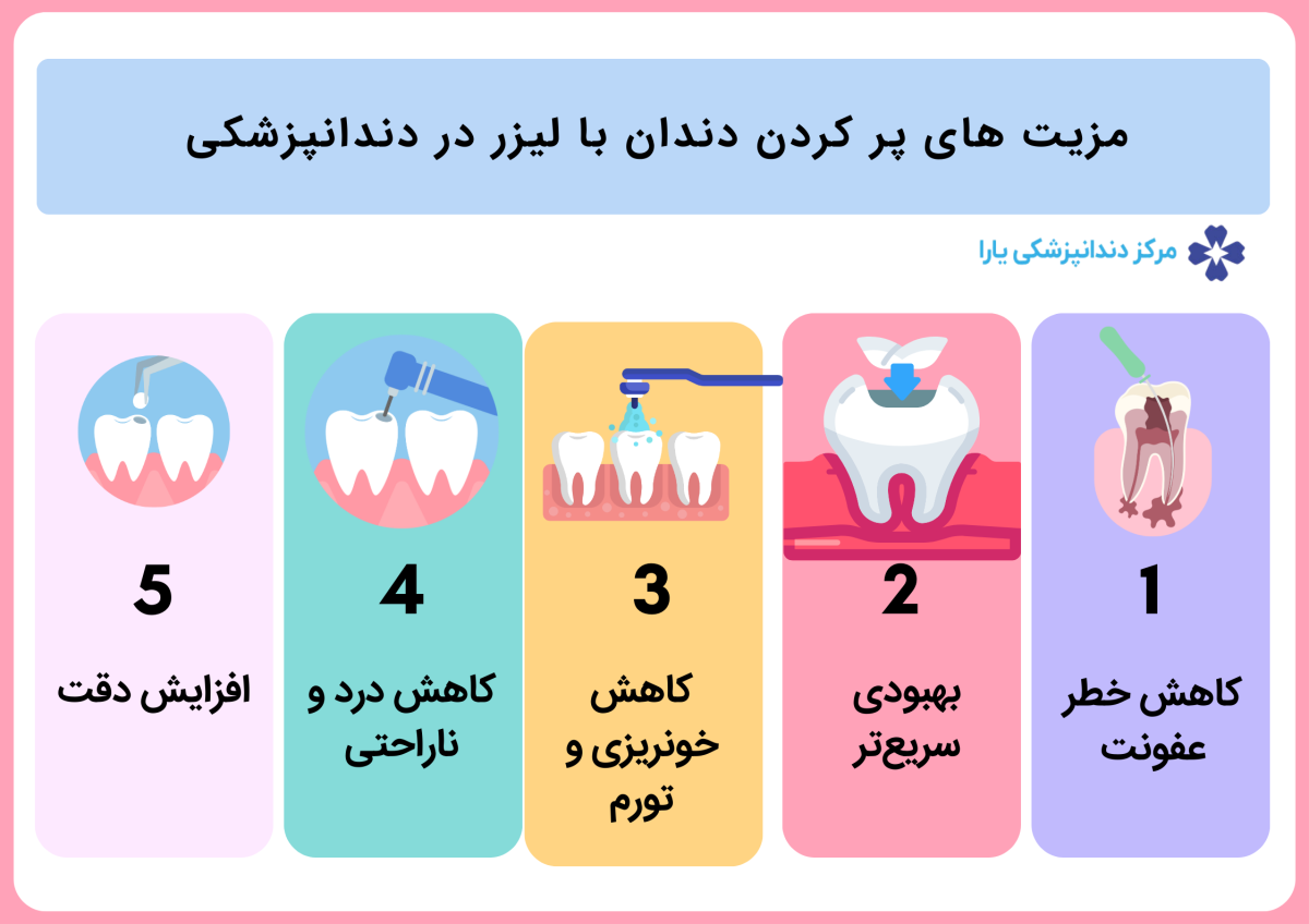 مزیت‌ های پر کردن دندان با لیزر در دندانپزشکی