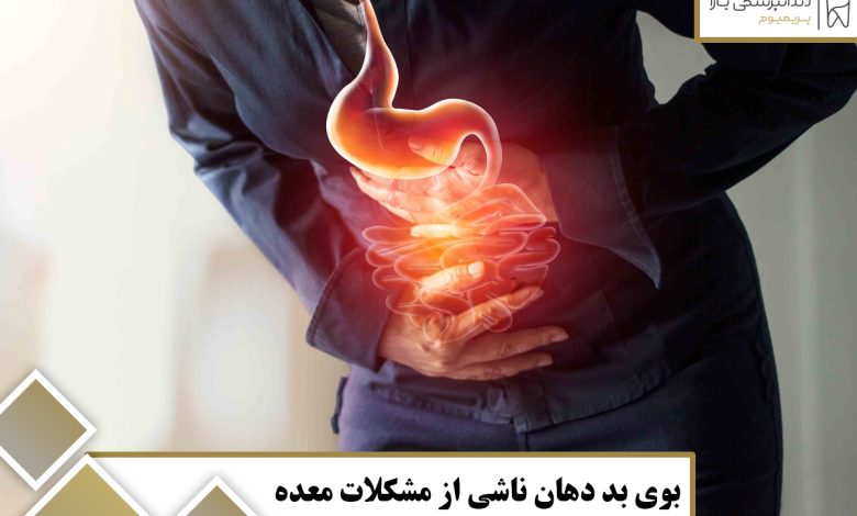 بوی بد دهان ناشی از مشکلات معده