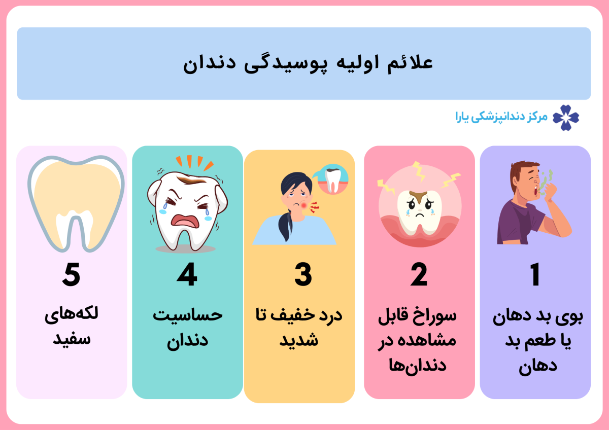 علائم اولیه پوسیدگی دندان 