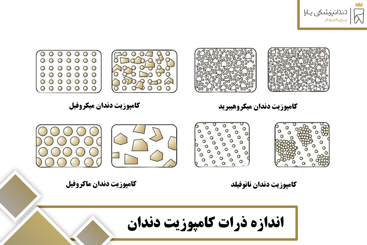  اندازه ذرات کامپوزیت دندان 