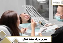 بهترین مارک لمینت دندان