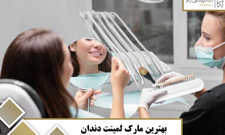 بهترین مارک لمینت دندان