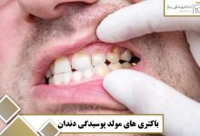 باکتری‌ های مولد پوسیدگی دندان