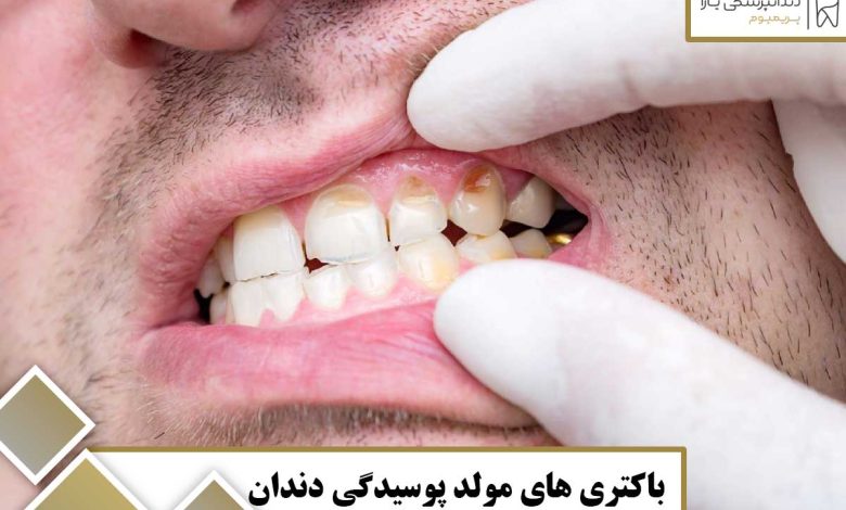 باکتری‌ های مولد پوسیدگی دندان