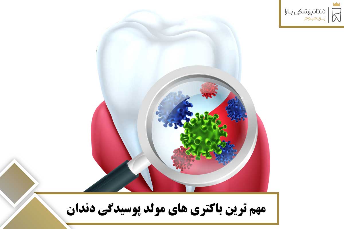 مهم ‌ترین باکتری ‌های مولد پوسیدگی دندان