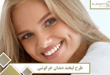 طرح لبخند دندان خرگوشی